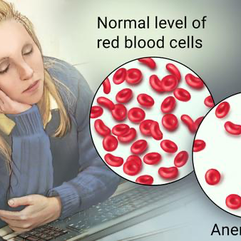 Do You Struggle With Low Iron ?