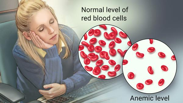 Do You Struggle With Low Iron ?